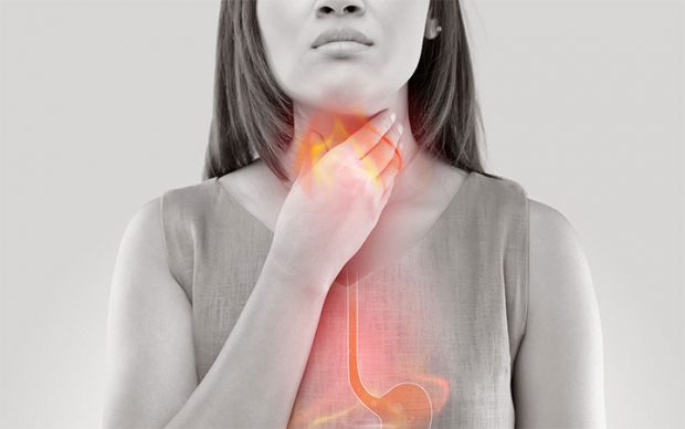 What You Must Know About Acid Reflux